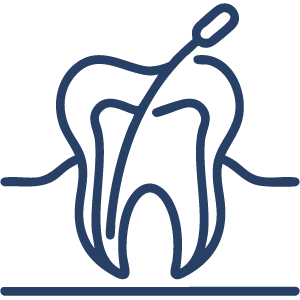 Home 6 root-canals